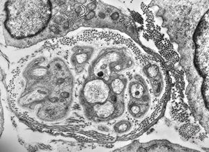 M, 3y. | cutaneous nerve M, 3y. | cutaneous nerve